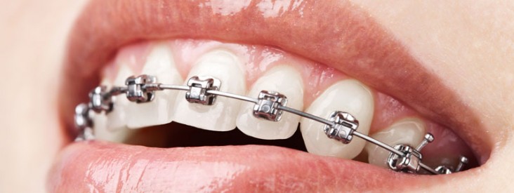 la ortodoncia