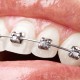 la ortodoncia